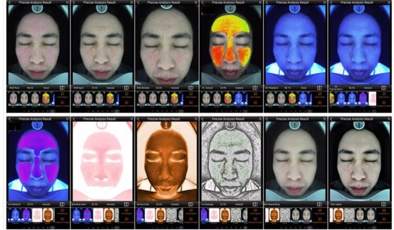 RGB UV συσκευή ανάλυσης δερμάτων της PL έξυπνη